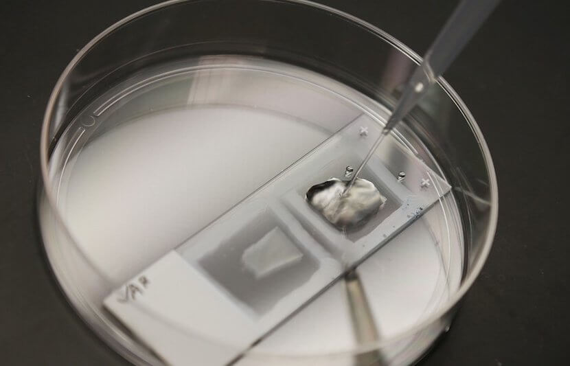 MIT and Harvard Medical School’s New Microscopy Technique Could Help Spot Cancer and Other Diseases Earlier and More Accurately Than Current Diagnostic Tools