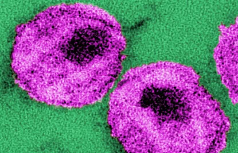 UCLA, Stanford and NIH’s ‘Kick and Kill’ Approach Could Eliminate Dormant HIV Virus