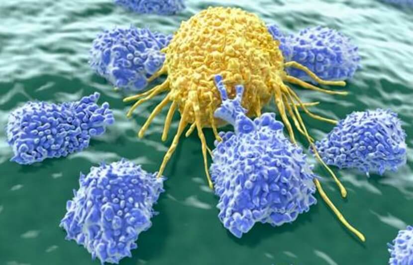 Cardiff University Researchers Develop Two Unique Methods to Attack Cancer