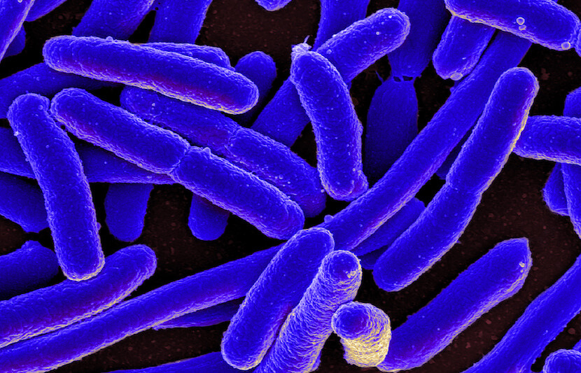 E. Coli Could Help Save the Planet