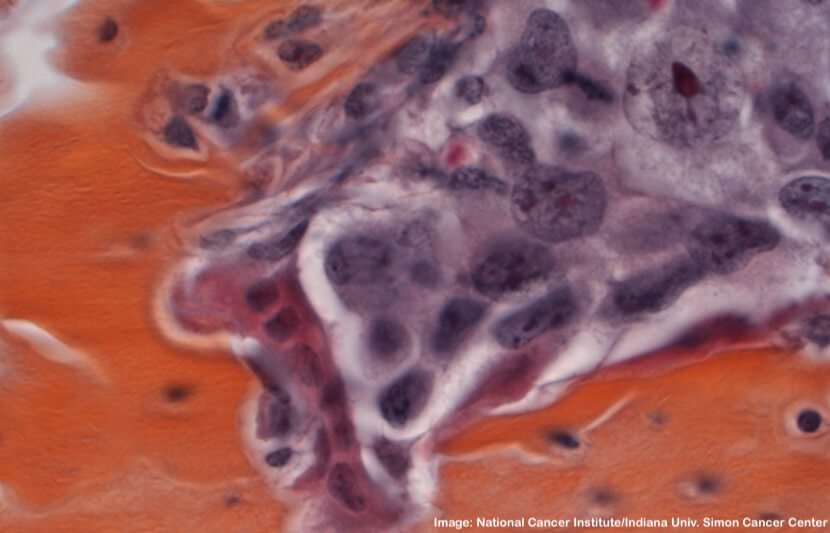 Women Killin’ It in Cancer Research