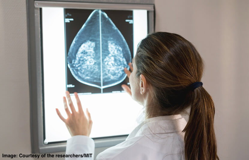 Is AI the Future of Breast Cancer Detection?